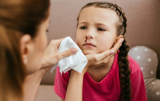 Temporada de calor: ¿Cuáles son las causas del sangrado nasal en niños?