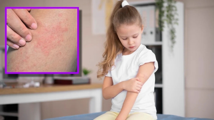 5 enfermedades que aparecen en los niños por falta de higiene, además de la dermatitis