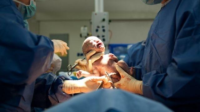 Se redujo hasta 20 por ciento natalidad en los últimos 17 meses