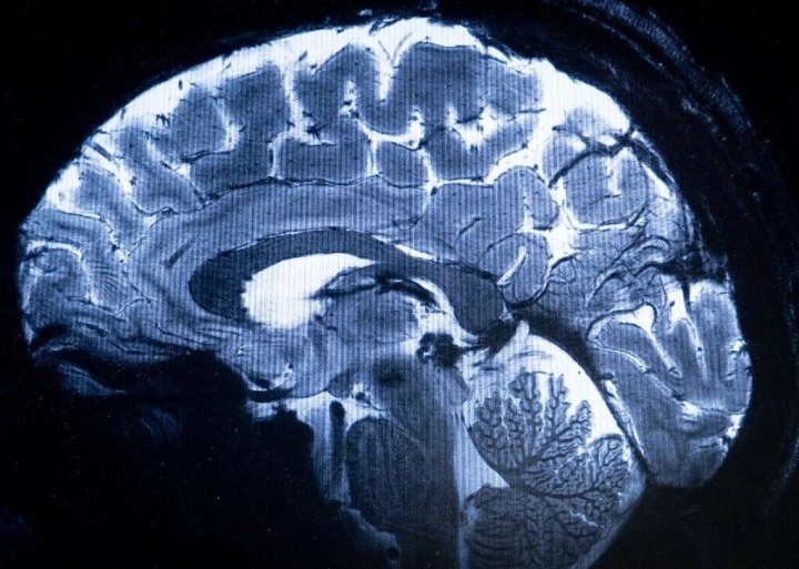 Crecimiento constante del cerebro humano reduciría riesgo de demencia, según estudio