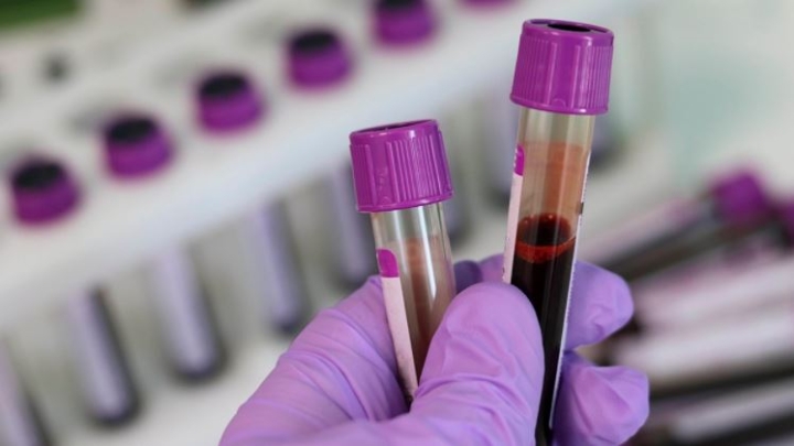 Crean el primer test de sangre que identifica si una persona tiene cáncer