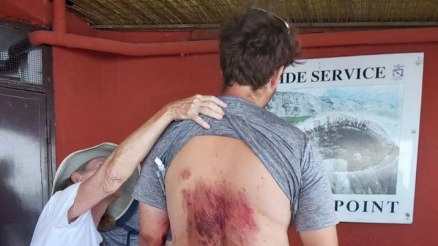 Un turista intentó sacarse una selfie y cayó al cráter del volcán Vesubio