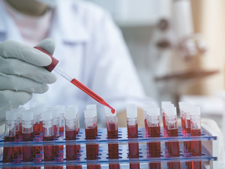 Hematólogos hallan una potencial nueva clasificación de grupos sanguíneos