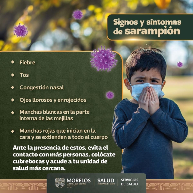 Vigilan caso de sarampión en Morelos