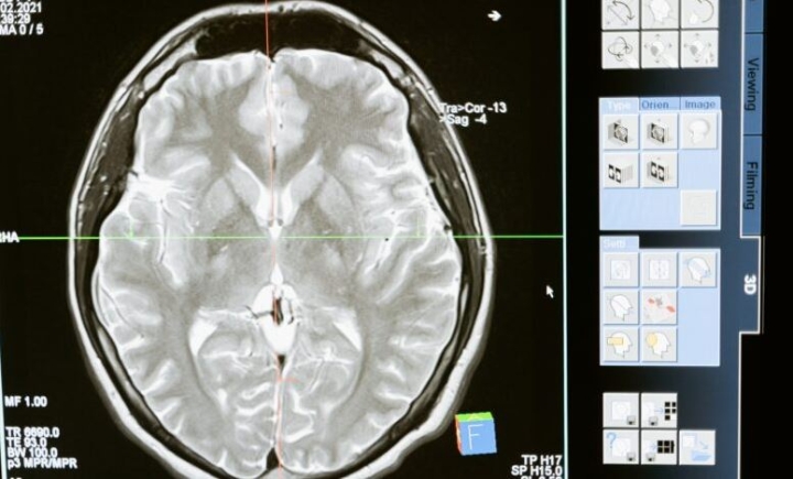 “Estudios sobre el cerebro humano deben analizar más de 12 casos”: experto