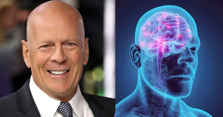 ¿Qué es la demencia frontotemporal, la enfermad que padece Bruce Willis?