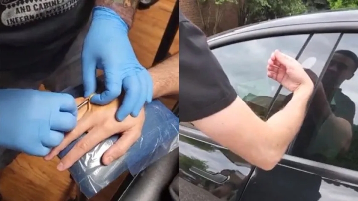 Joven se implanta bajo la piel chip para poder abrir su Tesla sin necesidad de llaves