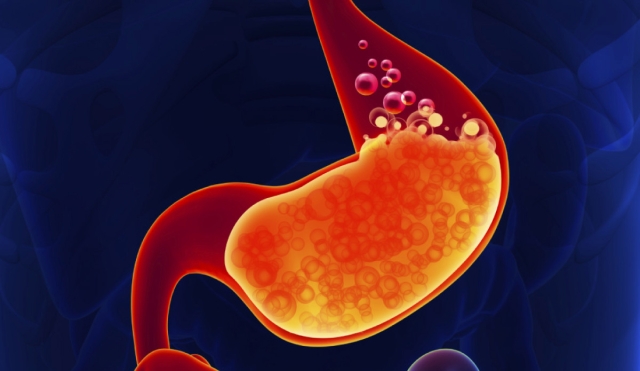 4 remedios sencillos y naturales para aliviar la acidez estomacal