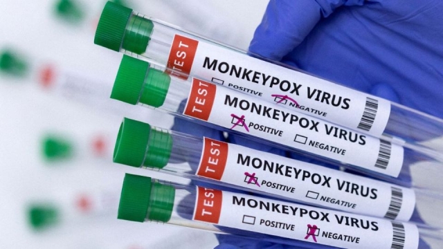 Viruela del mono aumenta contagios a 27 países y 780 casos confirmados