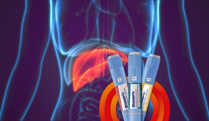 Ozempic podría ayudar a revertir el hígado graso, según estudio internacional