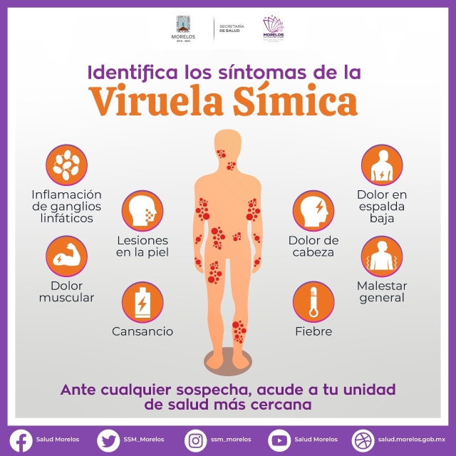 Notifica InDRE un nuevo caso con resultado positivo a viruela símica en Morelos
