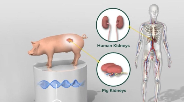 Dos riñones de cerdo son trasplantados por primera vez a una persona