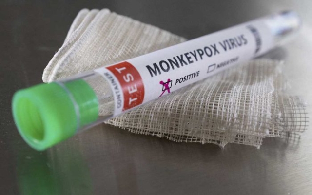 OMS eleva a 9,200 los casos de viruela del mono en todo el mundo