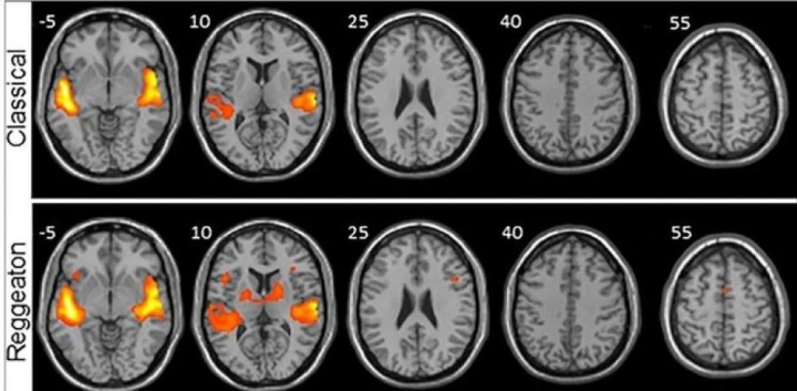 Estudio de expertos en neurociencia revela que el reggaetón genera mayor actividad cerebral que la música clásica