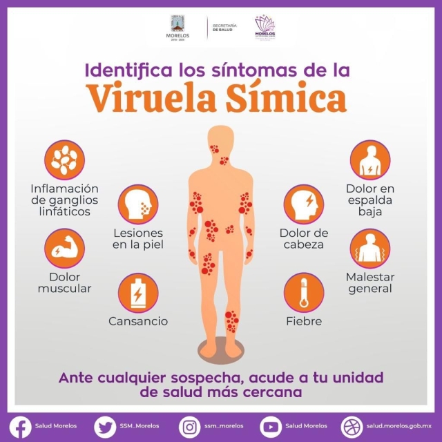 Confirman cuarto caso de viruela símica en Morelos