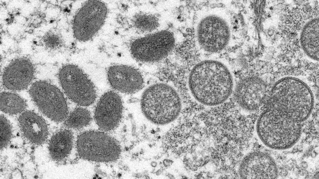 Alemania recomienda a grupos de riesgo vacunarse con Imvanex contra la viruela del mono