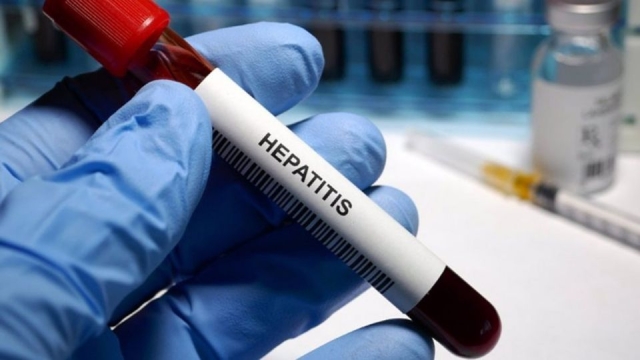 Brote de hepatitis en niños: ¿Cuáles son los síntomas de la enfermedad y cómo puedes infectarte?