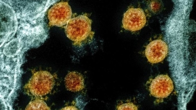 Marburgo: un nuevo virus mortal para el que no hay vacuna preocupa a la OMS