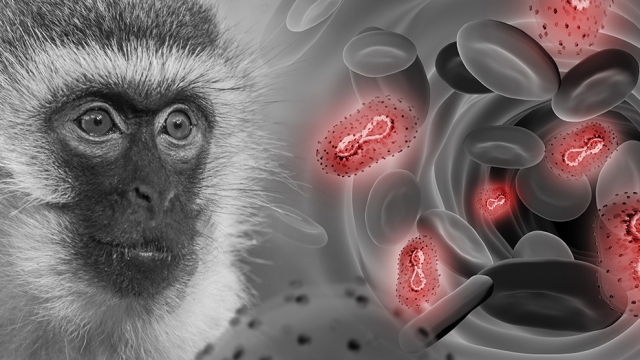 Viruela del mono: América ya es el epicentro del brote mundial, dice la OPS