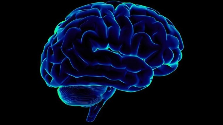Qué es un aneurisma cerebral y cuáles son los tratamientos