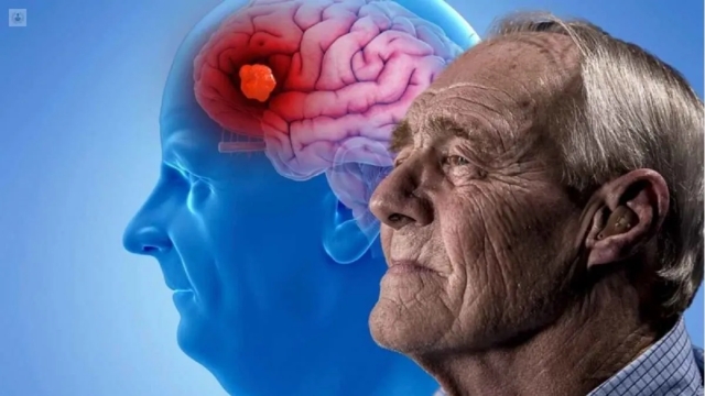 21 de Septiembre: Día de reflexión y concientización sobre el Alzheimer