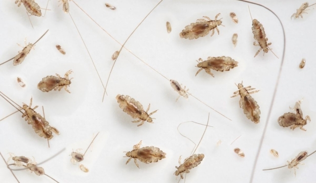 ¿Tienes piojos? Así puedes eliminarlos sin cortar el cabello